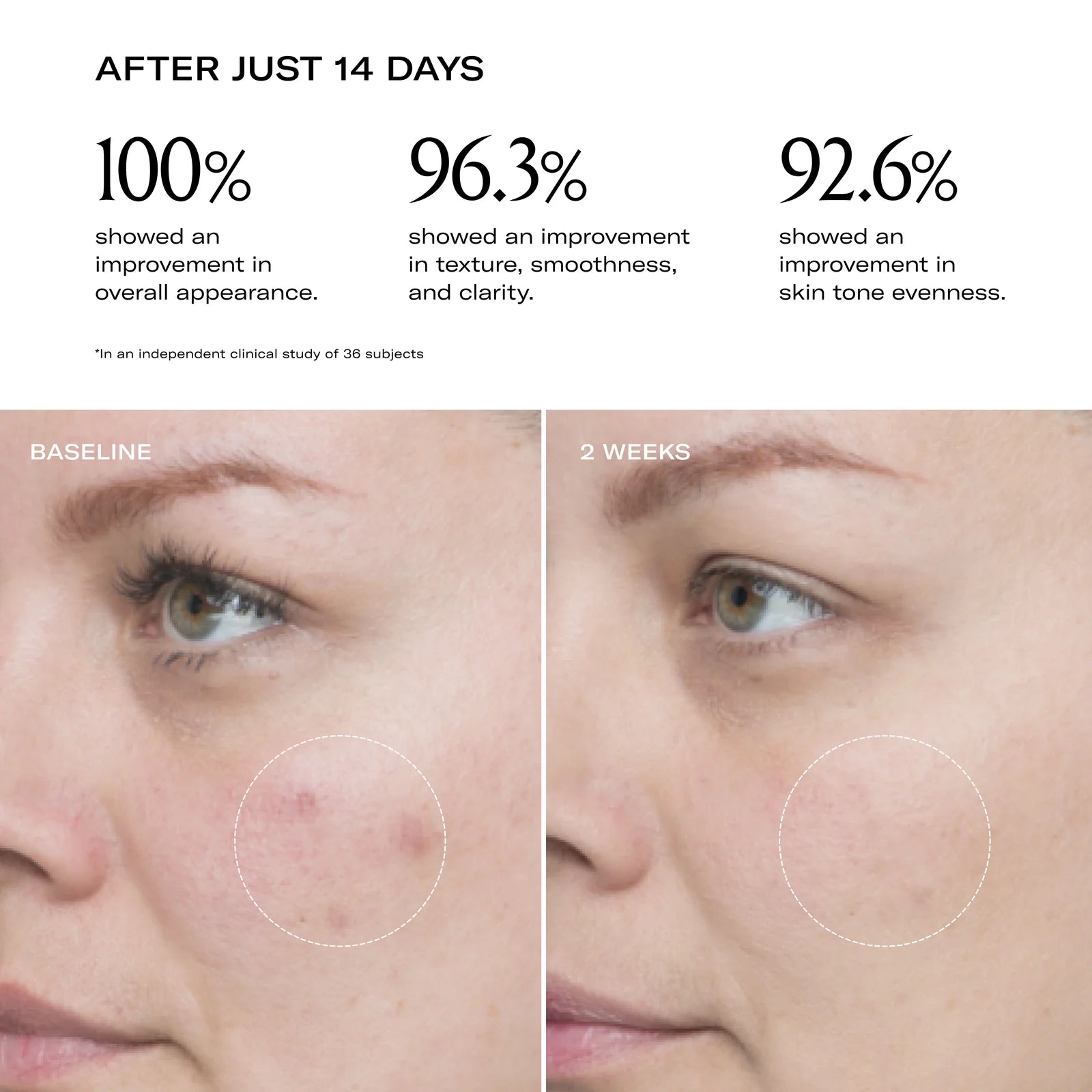 A before and after of a woman's face after using the plum screen for 2 weeks. 