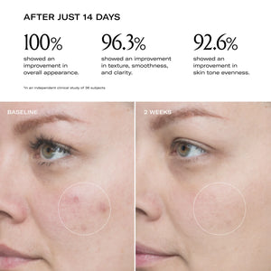 A before and after of a woman's face after using the plum screen for 2 weeks. 