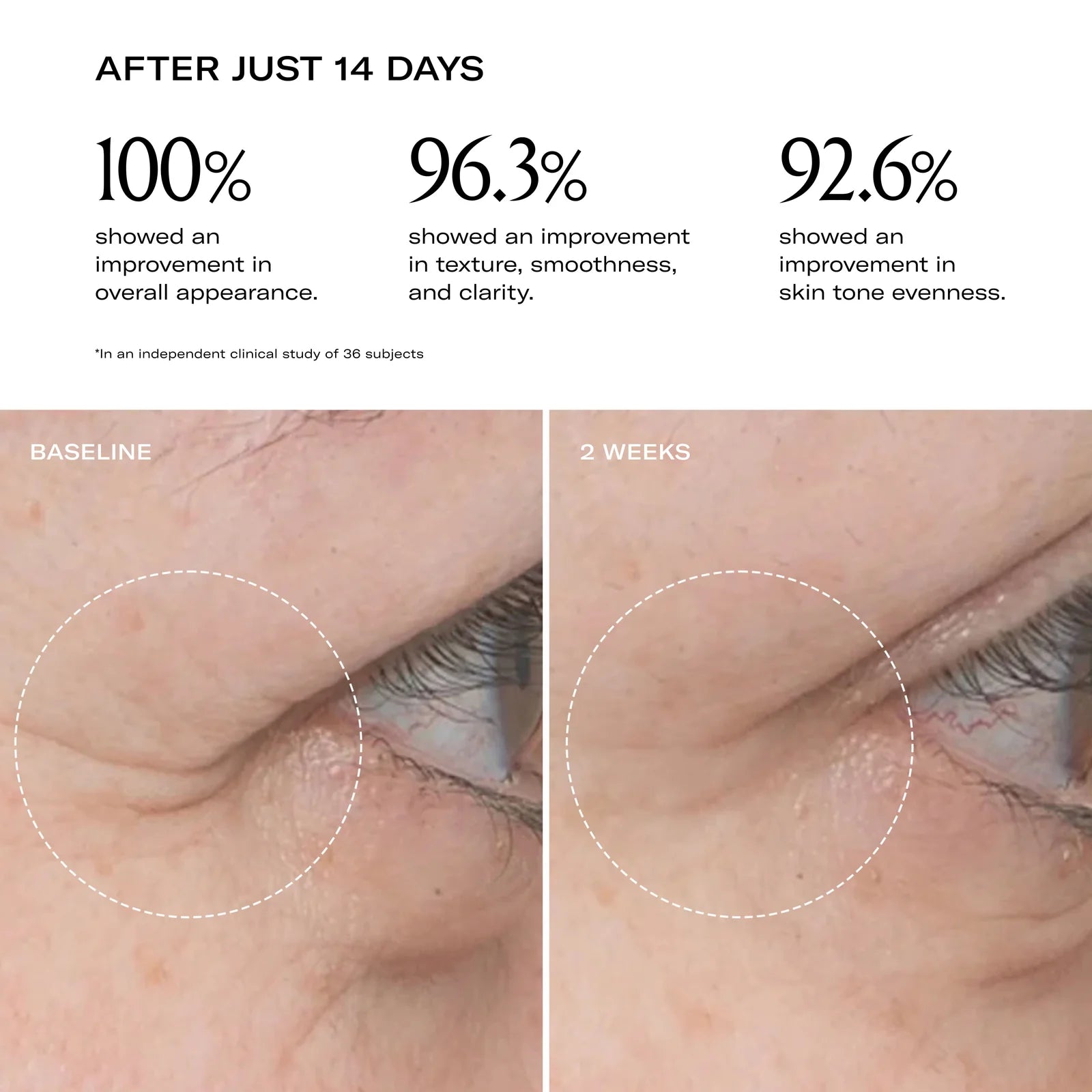 Before and after pictures of a person who has used the Plum Beauty Oil. 