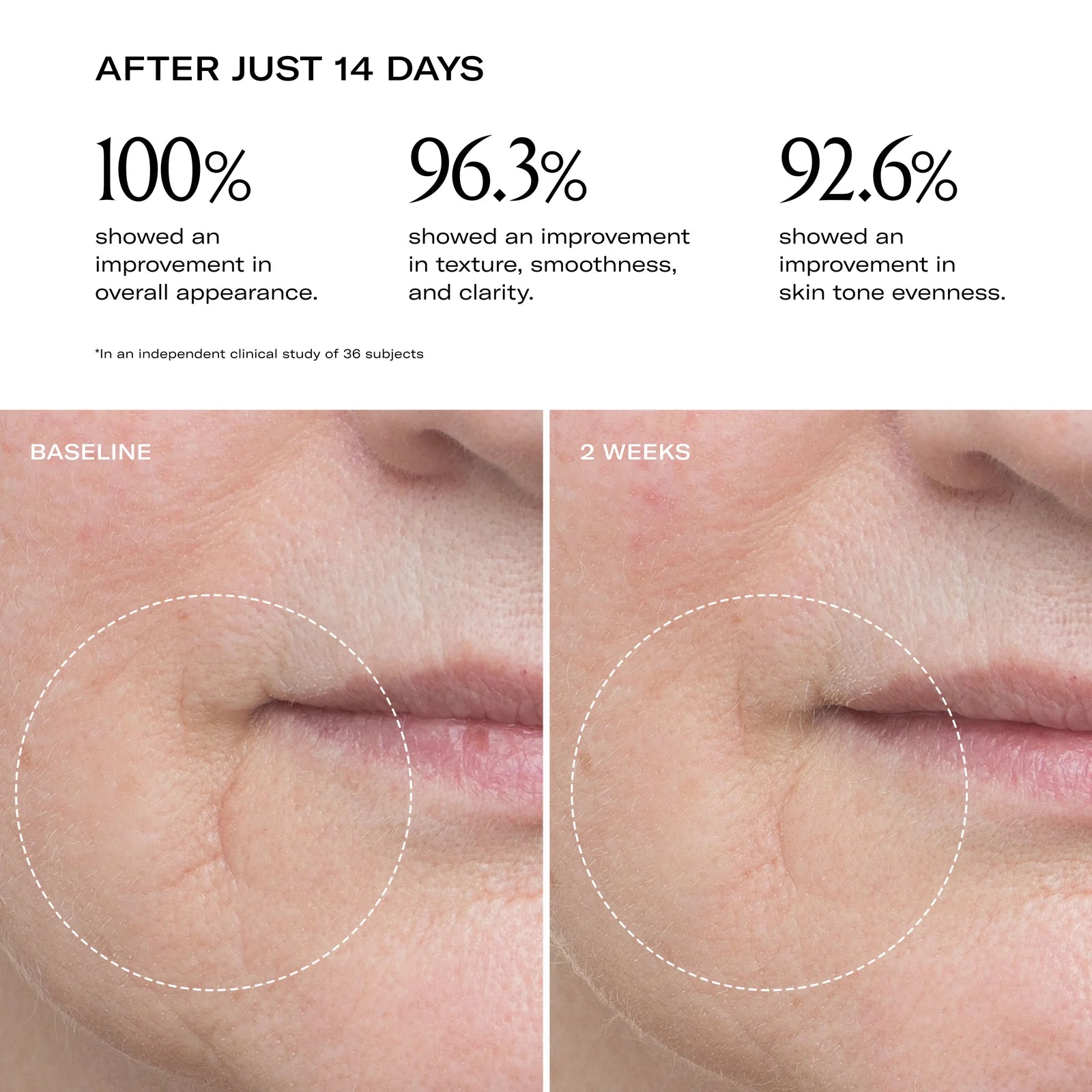 Before and after pictures of a person who has used the Plum Beauty Oil. 